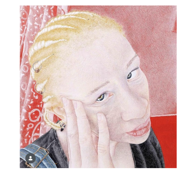 Artist Reframes Albinism Through Representation